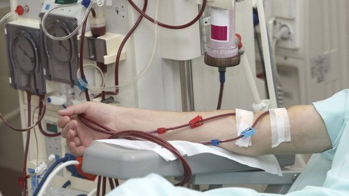 تامین نیاز بیماران کلیوی با تدوام تولید فیلترهای دیالیز در هلال احمر/ظرفیت تولید روزانه ۱۰ هزار فیلتر دیالیز
