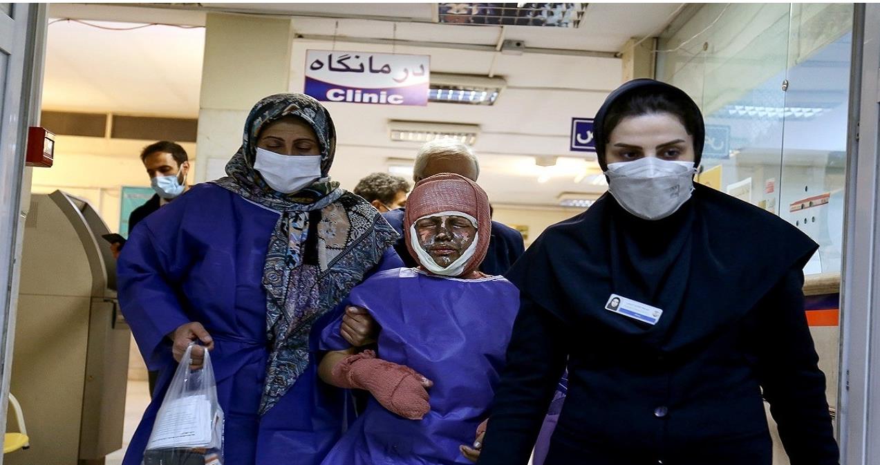 نحوه درمان خانگی افراد دچار سوختگی در چهارشنبه سوری/پیام سلامتی