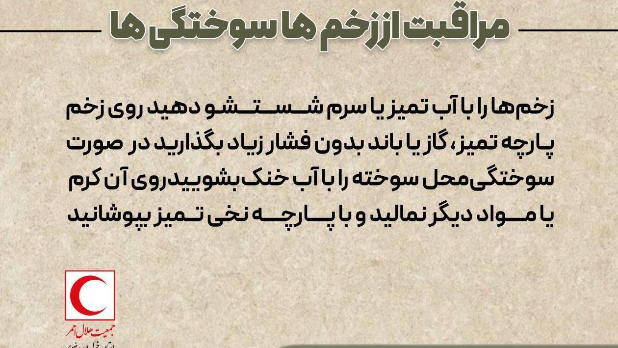 اطلاعیه آموزشی شماره ۳۵: «کمکهای اولیه در سوختگیهای ناشی از انفجار و حرارت» 