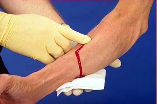 اطلاعیه آموزشی شماره 97: پانسمان زخم با حداقل لوازم در اختیار